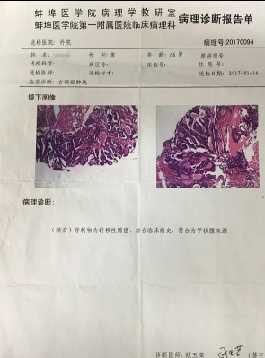 89UM9KUCC_97}H{JF6DXPC2.png