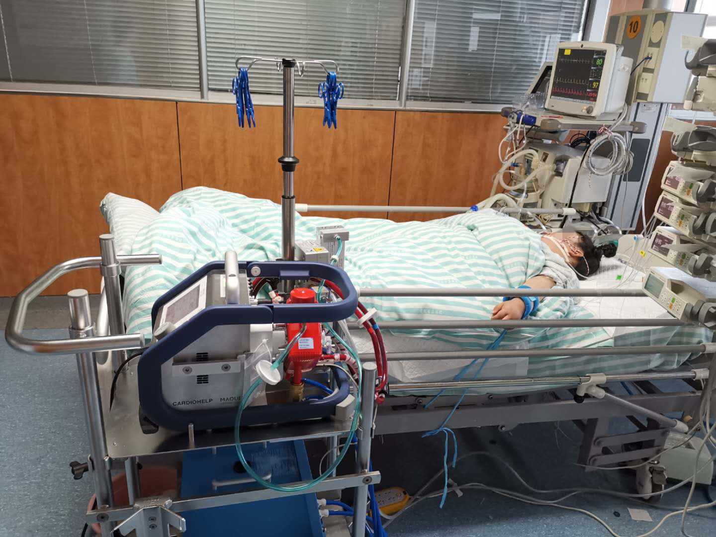 体外膜肺氧合(ecmo)技术是将体内的静脉血引出体外,经过人工心肺旁路